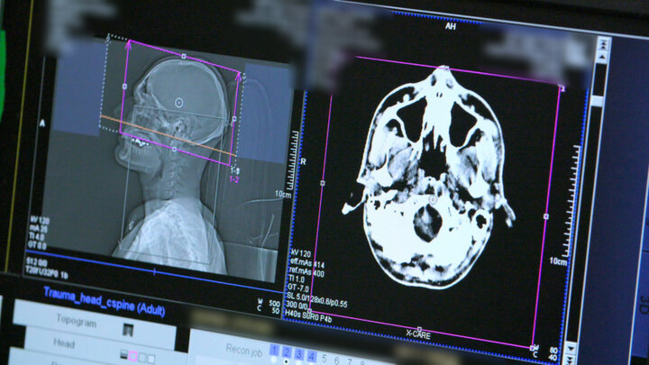 Crashed Brand-New Car