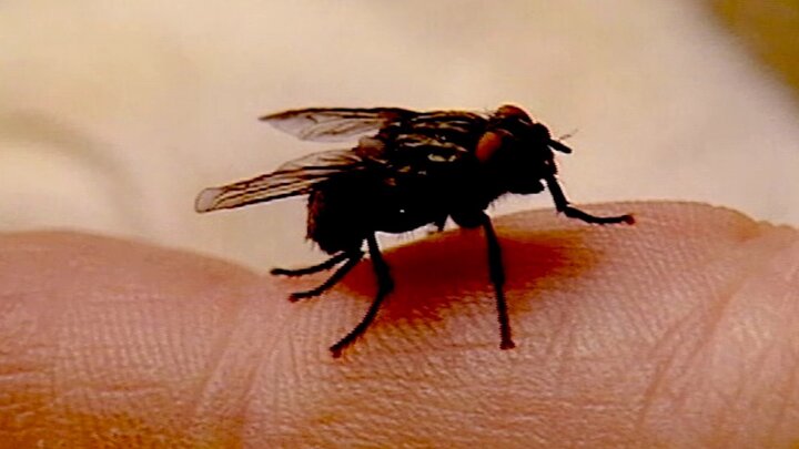 Legionnaires' Disease